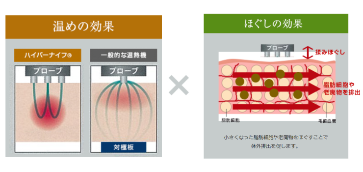 ハイパーナイフ仕組み