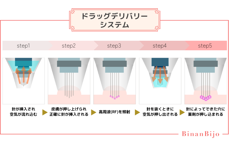 ポテンツァ[ドラッグデリバリー システム]の仕組み解説画像