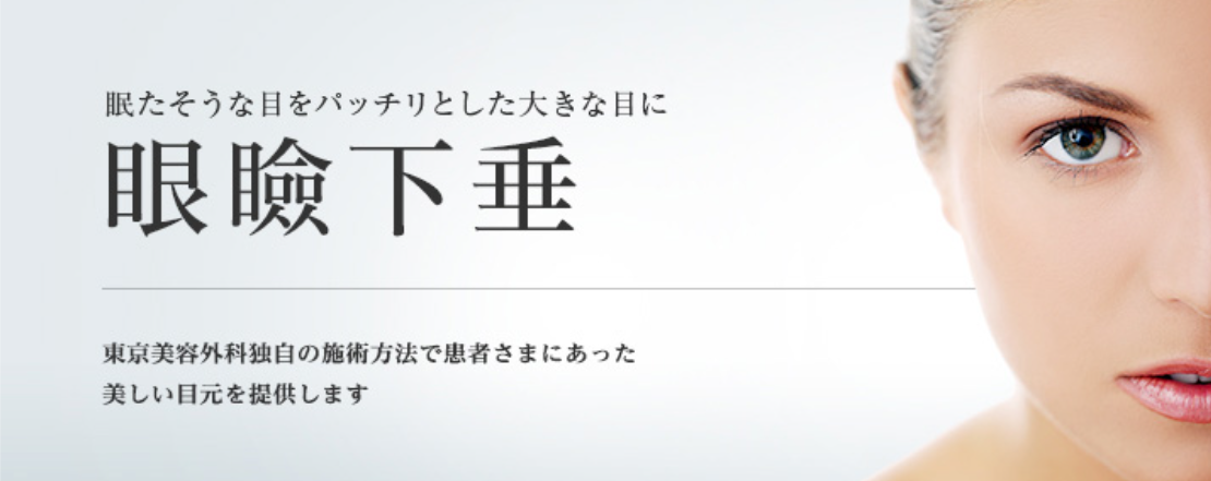 東京美容外科　眼瞼下垂