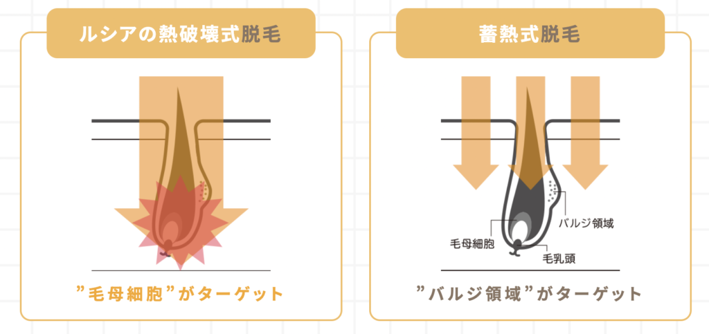 ルシアクリニック　名古屋　ヒゲ脱毛