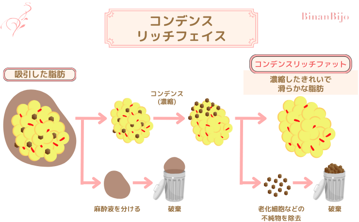 目の下のたるみ取り[SBCコンデンスリッチフェイス]