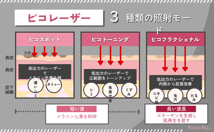 メンズシミ取り【ピコレーザー照射モード】