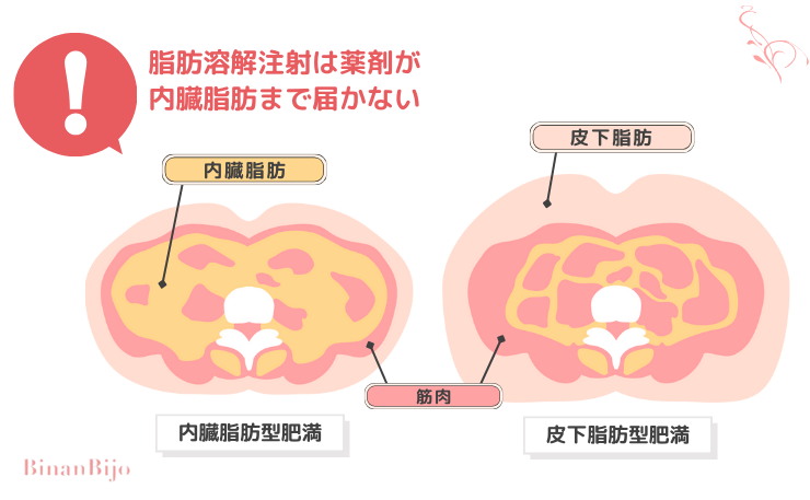 脂肪除去[内臓脂肪は効果なし]