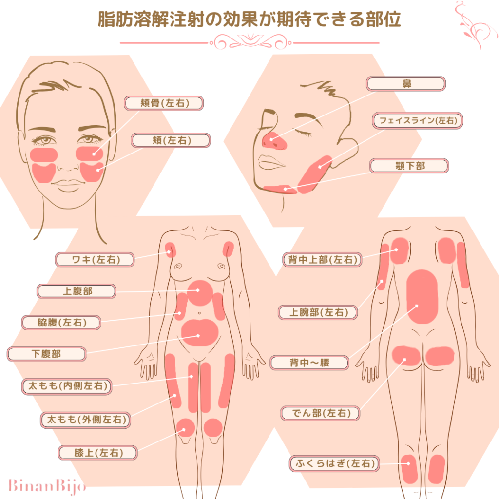 脂肪除去[溶解注射の適用部位]