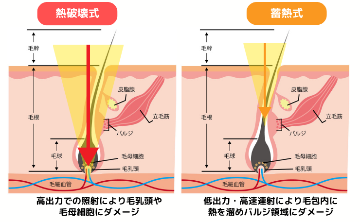 熱破壊式と蓄熱式の解説画像