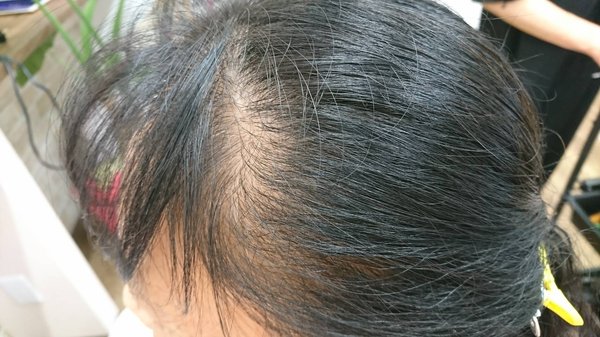 髪、肌を育てながら増毛エクステ(ヘアループ)ストレスから解放しましょう♪|美容室ナチュレ