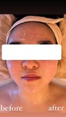  小顔になりたい方におすすめ②|ete Total Beauty Salon