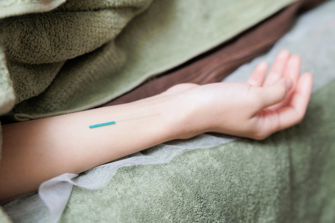 Oracule丸亀鍼灸院 | 丸亀のリラクゼーション Oracule丸亀鍼灸院 | 丸亀のリラクゼーション