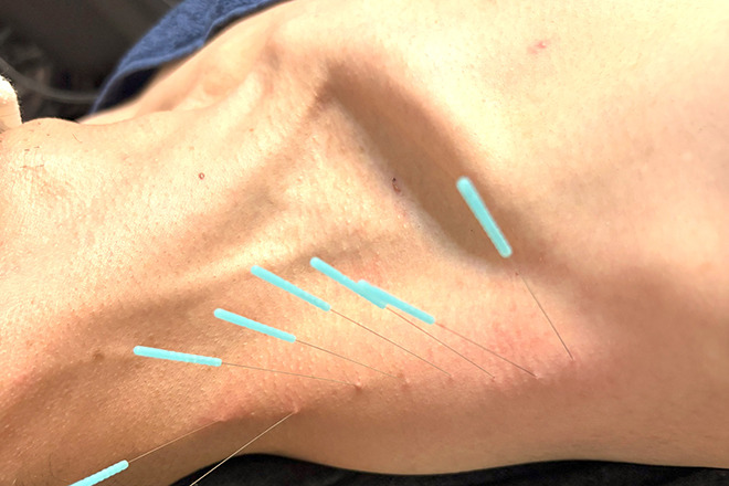 首こり肩こり腰痛自律神経 トリガーポイント広島とだ鍼灸院 | 八丁堀/白島/牛田のリラクゼーション 首こり肩こり腰痛自律神経 トリガーポイント広島とだ鍼灸院 | 八丁堀/白島/牛田のリラクゼーション