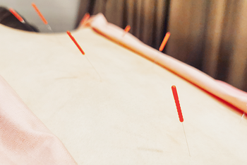 なな整骨院 | 十三のリラクゼーション なな整骨院 | 十三のリラクゼーション