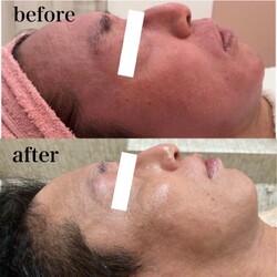 メンズ育毛/脱毛/フェイシャルサロンjoieange心斎橋店 | 心斎橋のエステサロン メンズ育毛/脱毛/フェイシャルサロンjoieange心斎橋店 | 心斎橋のエステサロン