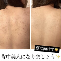 for woman | 栄/矢場町のエステサロン for woman | 栄/矢場町のエステサロン