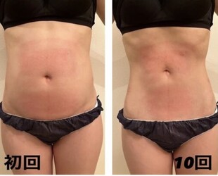 秒速スリム 銀座店 | 銀座のエステサロン 秒速スリム 銀座店 | 銀座のエステサロン