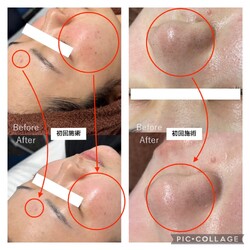 【肌質改善専門サロン/ハーブピーリング/ハイドラ】The Beauty麻布十番本店 | 麻布のエステサロン 【肌質改善専門サロン/ハーブピーリング/ハイドラ】The Beauty麻布十番本店 | 麻布のエステサロン