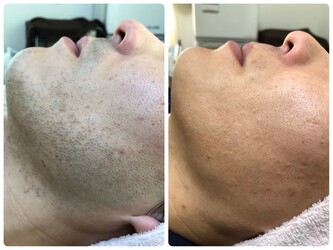 メンズ脱毛スキンケア GOLD PLUS 小牧店 | 小牧のエステサロン メンズ脱毛スキンケア GOLD PLUS 小牧店 | 小牧のエステサロン