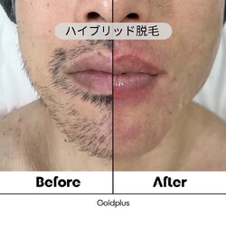 美肌脱毛専門店 Pearl plus 新倉敷店 | 倉敷のエステサロン 美肌脱毛専門店 Pearl plus 新倉敷店 | 倉敷のエステサロン