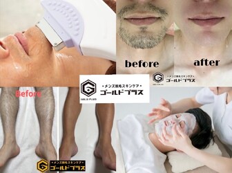 美肌脱毛専門店 Pearl plus 東岡山店【パールプラス】【小顔/痩身/フェイシャル】 | 岡山のエステサロン 美肌脱毛専門店 Pearl plus 東岡山店【パールプラス】【小顔/痩身/フェイシャル】 | 岡山のエステサロン