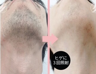 脱毛&痩身 GLYCINE | 心斎橋のエステサロン 脱毛&痩身 GLYCINE | 心斎橋のエステサロン