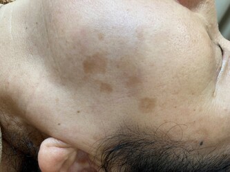 アニー エステ | 立川のエステサロン アニー エステ | 立川のエステサロン