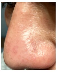 プルーメリア | 金山のエステサロン プルーメリア | 金山のエステサロン