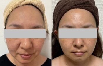 エステティック ルモーロ【Lumoro】 | 栄/矢場町のエステサロン エステティック ルモーロ【Lumoro】 | 栄/矢場町のエステサロン