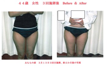 前田カイロプラクティック整体院ダイエット | 高知のエステサロン 前田カイロプラクティック整体院ダイエット | 高知のエステサロン