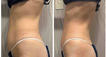 body salon Futh | 本町のエステサロン body salon Futh | 本町のエステサロン