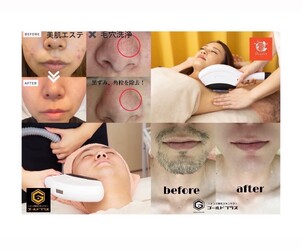 美肌脱毛&トータルビューティー パールプラス 中津店 | 中津のエステサロン 美肌脱毛&トータルビューティー パールプラス 中津店 | 中津のエステサロン