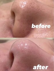 beautysalon Stella | 稲毛のエステサロン beautysalon Stella | 稲毛のエステサロン