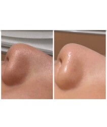 Ultimate | 心斎橋のエステサロン Ultimate | 心斎橋のエステサロン