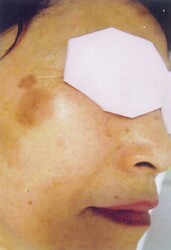 リラクエステ希望 | 仙台のエステサロン リラクエステ希望 | 仙台のエステサロン