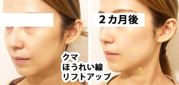 et Luxe | 三宮のエステサロン et Luxe | 三宮のエステサロン