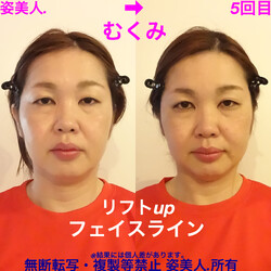 3D小顔矯正+筋膜リリース+肩甲骨はがし+姿勢 「姿美人.」(シルエット) | 九条/弁天町のリラクゼーション 3D小顔矯正+筋膜リリース+肩甲骨はがし+姿勢 「姿美人.」(シルエット) | 九条/弁天町のリラクゼーション