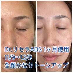 ナチュローズ新小岩 | 小岩のエステサロン ナチュローズ新小岩 | 小岩のエステサロン