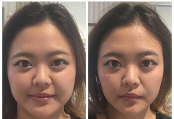 即痩せ専門むくみ研究所心斎橋店 | 心斎橋のエステサロン 即痩せ専門むくみ研究所心斎橋店 | 心斎橋のエステサロン