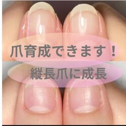 深爪 自爪育成 脱毛サロン elle& | 灘/六甲(摩耶)のネイルサロン 深爪 自爪育成 脱毛サロン elle& | 灘/六甲(摩耶)のネイルサロン