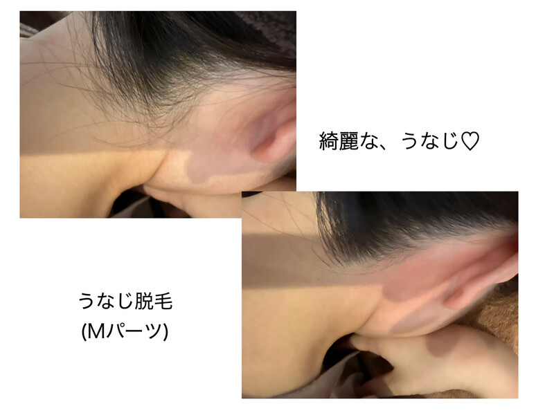 BeautyCareRoom MOELLEUX | 豊橋のエステサロン