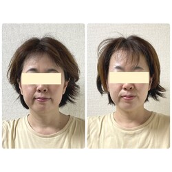 小顔矯正サロン クレール | 祖師ヶ谷大蔵のリラクゼーション 小顔矯正サロン クレール | 祖師ヶ谷大蔵のリラクゼーション