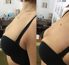 中津市でダイエットやバストアップ.脱毛などの見た目を変える整体 | 中津のエステサロン 中津市でダイエットやバストアップ.脱毛などの見た目を変える整体 | 中津のエステサロン