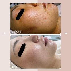 レゾン 京橋店 | 京橋のエステサロン レゾン 京橋店 | 京橋のエステサロン