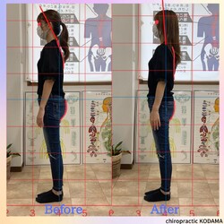 カイロプラクティックKODAMA | 大曽根/黒川のリラクゼーション カイロプラクティックKODAMA | 大曽根/黒川のリラクゼーション