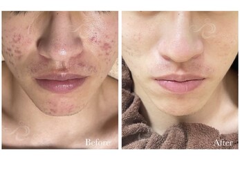 S salon | 札幌駅周辺のエステサロン S salon | 札幌駅周辺のエステサロン