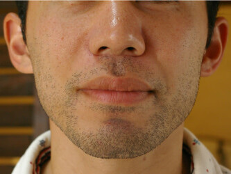 脱毛工房 SaKoN | 蘇我のエステサロン 脱毛工房 SaKoN | 蘇我のエステサロン