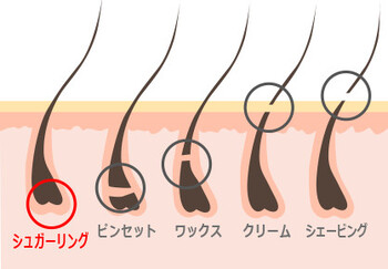 シュガーリング&ブラジリアンワックス 脱毛 Lamina新宿 | 新宿のエステサロン シュガーリング&ブラジリアンワックス 脱毛 Lamina新宿 | 新宿のエステサロン