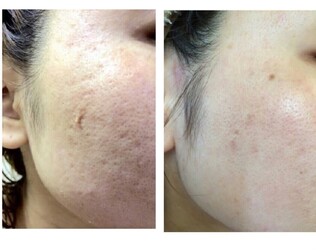 Re Ange豊見城店 | 那覇のエステサロン Re Ange豊見城店 | 那覇のエステサロン