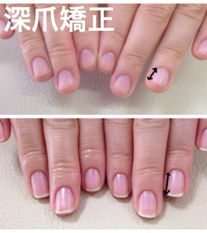 I Nail アイネイル アイネイル 大阪府 河内長野 のネイルサロン ビューティーパーク