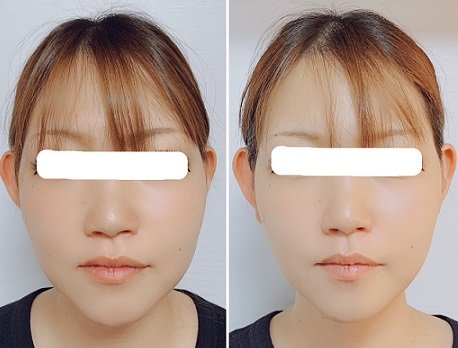 未来身体づくりsalon kohaku | 和歌山のエステサロン