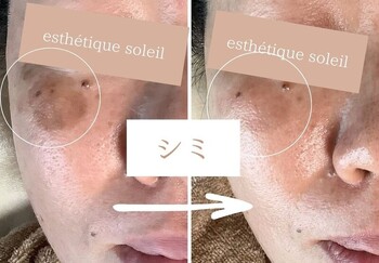 esthetique soleil | 三島のエステサロン esthetique soleil | 三島のエステサロン