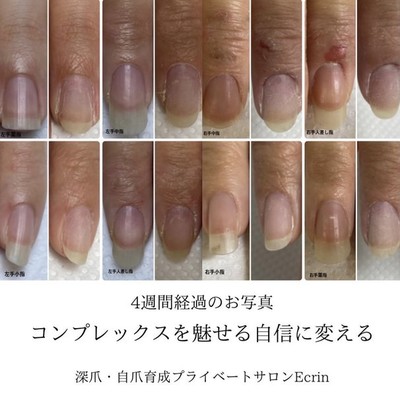 Nailsalon Ecrin ネイルサロンエクラン 兵庫県 尼崎 のネイルサロン ビューティーパーク