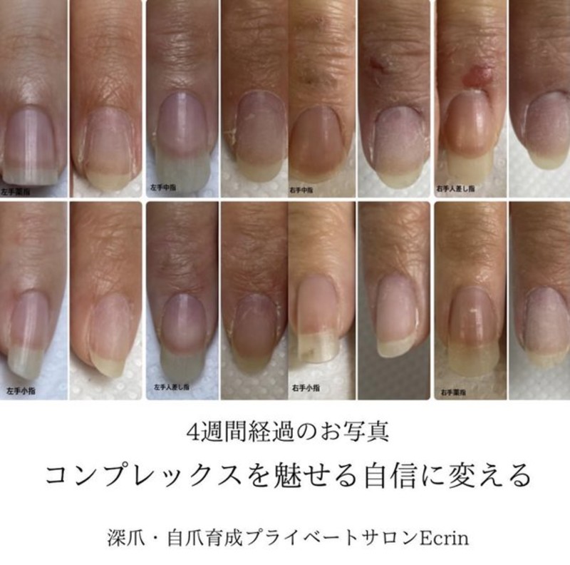 Nailsalon Ecrin ネイルサロンエクラン 兵庫県 尼崎 のネイルサロン ビューティーパーク